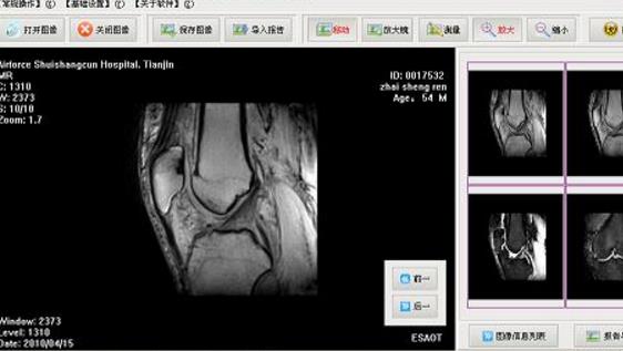 dicom图像浏览器(PhilipsDICOMViewer)绿色版截图2