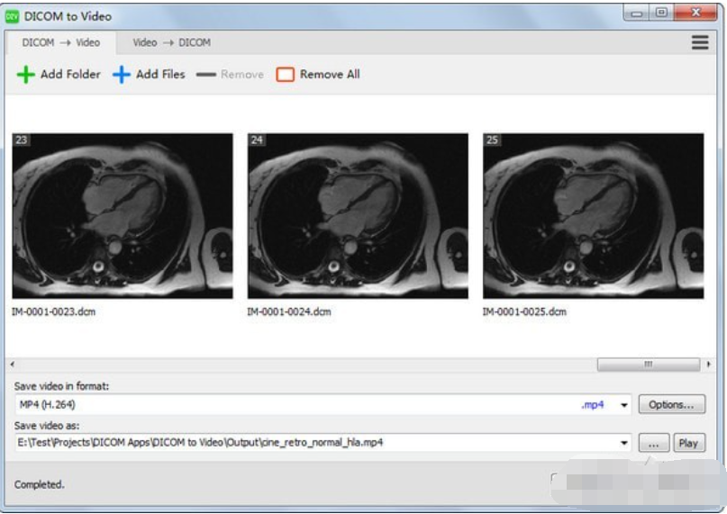 DICOMtoVideo(DICOM转视频工具)截图1