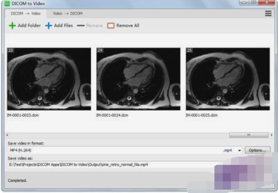 DICOMtoVideo(DICOM转视频工具)截图2